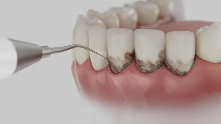 Reliable Teeth Cleaning And Checkup contractor in York County County, VA by Dentist Open Now